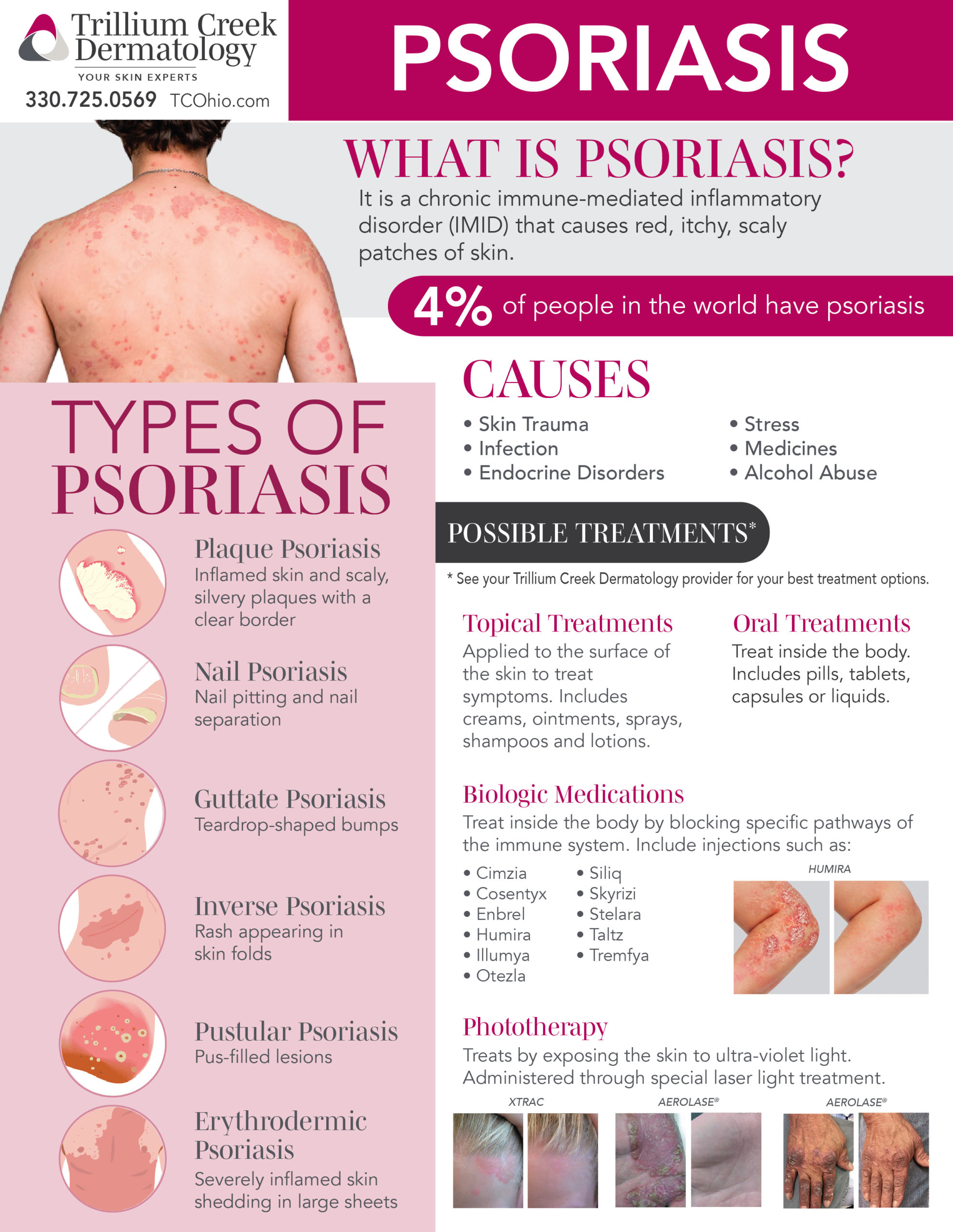 mild psoriasis on face